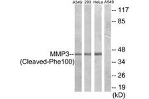 Western blot analysis of extracts from A549/293/HeLa cells, treated with etoposide 25uM 24h, using MMP3 (Cleaved-Phe100) Antibody. (MMP3 antibody  (Cleaved-Phe100))