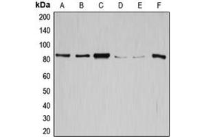 Western blot analysis of GYS1 expression in SW626 (A), SKOV3 (B), HeLa (C), K562 (D), HepG2 (E), mouse liver (F) whole cell lysates. (Glycogen Synthase 1 antibody  (C-Term))