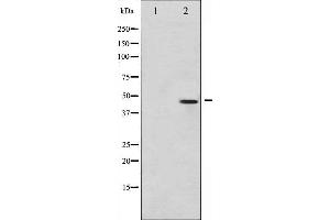 Western Blotting (WB) image for anti-Jun Proto-Oncogene (JUN) (pSer73) antibody (ABIN6255488)