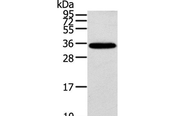 KCNMB3 antibody