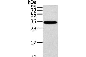Western Blot analysis of Mouse brain tissue using KCNMB3 Polyclonal Antibody at dilution of 1:300