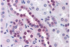 Human Kidney: Formalin-Fixed, Paraffin-Embedded (FFPE) (STK33 antibody  (AA 1-515))