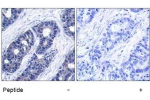 Image no. 1 for anti-Insulin Receptor Substrate 1 (IRS1) (Ser636) antibody (ABIN197467) (IRS1 antibody  (Ser636))