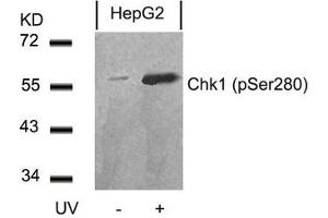 Western blot analysis of extracts from HepG2 cells untreated or treated with UV using Chk1(Phospho-Ser280) Antibody. (CHEK1 antibody  (pSer280))