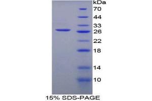 SDS-PAGE (SDS) image for phosphofructokinase, Platelet (PFKP) (AA 553-753) protein (His tag) (ABIN1879005)