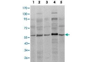 Western blot analysis of SMAD4 monoclonal antobody, clone 4G1C6  against A-431 (1), SK-N-SH (2), K-562 (3), HepG2 (4) and HUVE12 (5) cell lysate. (SMAD4 antibody)