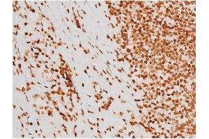 ABIN6267604 at 1/200 staining Human tonsil tissue sections by IHC-P. (c-Rel antibody  (pSer503))