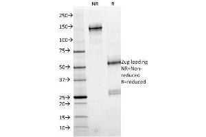 SDS-PAGE Analysis Purified SMAD4 Mouse Monoclonal Antibody (SMAD4/2524). (STAT6 antibody)