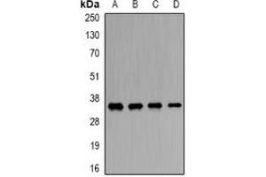 Western blot analysis of ORC6 expression in SW620 (A), Hela (B), mouse liver (C), rat brain (D) whole cell lysates. (ORC6 antibody)