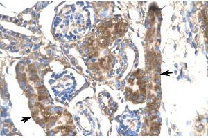 Human kidney; SLC17A2 antibody - middle region in Human kidney cells using Immunohistochemistry (SLC17A2 antibody  (Middle Region))