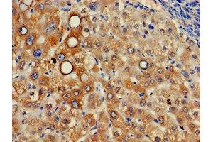 Immunohistochemistry of paraffin-embedded human liver tissue using ABIN7156381 at dilution of 1:100