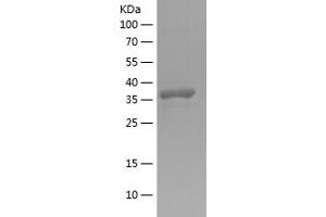 Western Blotting (WB) image for Angiopoietin-Like 2 (ANGPTL2) (AA 23-135) protein (His-IF2DI Tag) (ABIN7121830) (ANGPTL2 Protein (AA 23-135) (His-IF2DI Tag))