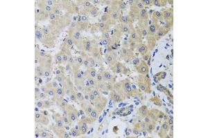 Immunohistochemistry of paraffin-embedded human liver injury using MB21D1 antibody. (C6orf150 antibody)