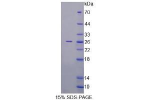 SDS-PAGE (SDS) image for RAB1A, Member RAS Oncogene Family (RAB1A) (AA 2-205) protein (His tag) (ABIN6237606)
