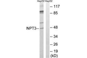 Western Blotting (WB) image for anti-Solute Carrier Family 17 (Anion/Sugar Transporter), Member 2 (SLC17A2) (AA 213-262) antibody (ABIN2890650)