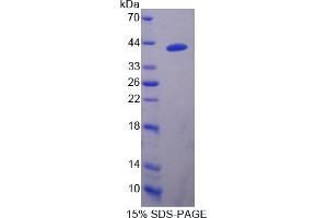 Image no. 1 for DnaJ (Hsp40) Homolog, Subfamily B, Member 1 (DNAJB1) (AA 2-340) protein (His tag) (ABIN4988548)