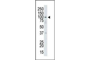 Image no. 1 for anti-Ubiquitin Specific Peptidase 13 (Isopeptidase T-3) (USP13) (Middle Region) antibody (ABIN357545) (USP13 antibody  (Middle Region))