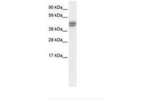 Image no. 1 for anti-SAP30 Binding Protein (SAP30BP) (AA 35-84) antibody (ABIN6736065) (SAP30BP antibody  (AA 35-84))