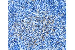 Immunohistochemistry of paraffin-embedded Rat spleen using PAICS Polyclonal Antibody at dilution of 1:100 (40x lens). (PAICS antibody)