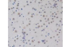 Used in DAB staining on fromalin fixed paraffin- embedded brain tissue (CEBPD antibody  (AA 51-251))