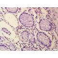 anti-N-Myc Proto-Oncogene Protein (MYCN) (AA 401-464) antibody