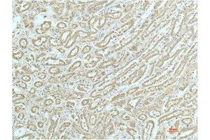 Immunohistochemical analysis of paraffin-embedded Human Kidney Tissue using a-actinin Mouse mAb diluted at 1:200. (ACTN1 antibody)