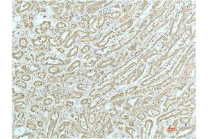 Immunohistochemical analysis of paraffin-embedded Human Kidney Tissue using a-actinin Mouse mAb diluted at 1:200.