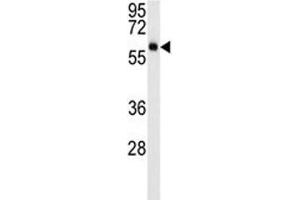 Western Blotting (WB) image for anti-V-Akt Murine Thymoma Viral Oncogene Homolog 3 (Protein Kinase B, Gamma) (AKT3) antibody (ABIN3029481)
