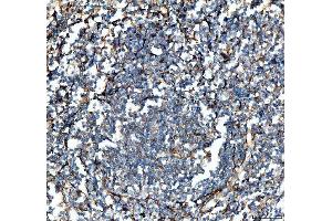 IHC analysis of VCAM1 using anti-VCAM1 antibody (ABIN5692810).