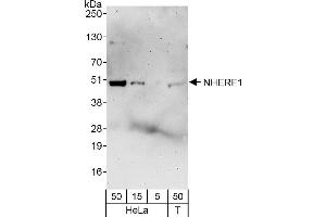 Western Blotting (WB) image for anti-Solute Carrier Family 9, Subfamily A (NHE3, Cation Proton Antiporter 3), Member 3 Regulator 1 (SLC9A3R1) (AA 325-358) antibody (ABIN7453744)
