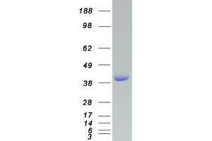 Validation with Western Blot (VASP Protein (Myc-DYKDDDDK Tag))