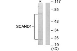Western Blotting (WB) image for anti-SCAN Domain Containing 1 (SCAND1) (AA 61-110) antibody (ABIN2889527) (SCAND1 antibody  (AA 61-110))