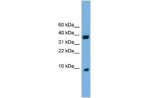 WB Suggested Anti-RPS21 Antibody Titration: 0. (RPS21 antibody  (Middle Region))