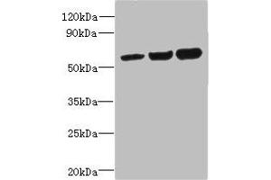 Western blot All lanes: OSBPL2 antibody at 1 μg/mL Lane 1: HepG2 whole cell lysate Lane 2: Mouse heart tissue Lane 3: Hela whole cell lysate Secondary Goat polyclonal to rabbit IgG at 1/10000 dilution Predicted band size: 56, 54 kDa Observed band size: 56 kDa (OSBPL2 antibody  (AA 251-480))
