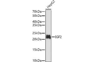 Western blot analysis of extracts of HepG2 cells, using IGF2 antibody (ABIN3022872, ABIN3022873, ABIN3022874 and ABIN6219274) at 1:1000 dilution.