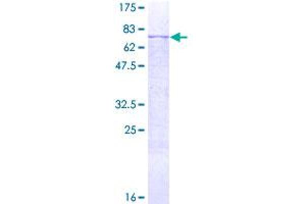 MMP12 Protein (AA 1-470) (GST tag)