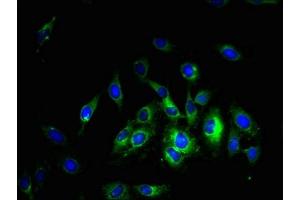 Immunofluorescent analysis of Hela cells using ABIN7169968 at dilution of 1:100 and Alexa Fluor 488-congugated AffiniPure Goat Anti-Rabbit IgG(H+L) (Slc38a5 antibody  (AA 1-48))