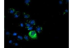 Immunofluorescence (IF) image for anti-alpha-Fetoprotein (AFP) antibody (ABIN1496486) (alpha Fetoprotein antibody)