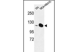 Western blot analysis of DIH2 Antibody (Center) 9407c in 293, MDA-M cell line lysates (35 μg/lane). (DIAPH2 antibody  (AA 870-899))