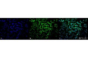 Immunocytochemistry/Immunofluorescence analysis using Rabbit Anti-TNF-R1 Polyclonal Antibody . (TNFRSF1A antibody  (AA 20-43) (Atto 594))