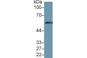 Western Blotting (WB) image for anti-Aldehyde Dehydrogenase 1 Family, Member B1 (ALDH1B1) (AA 18-517) antibody (ABIN7445501)