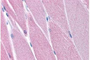 Human Skeletal Muscle (formalin-fixed, paraffin-embedded) stained with PDK4 antibody ABIN214801 at 5 ug/ml followed by biotinylated goat anti-rabbit IgG secondary antibody ABIN481713, alkaline phosphatase-streptavidin and chromogen. (PDK4 antibody  (N-Term))