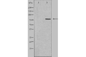 Western blot analysis of extracts from HeLa cells, using CEP78 antibody. (CEP78 antibody  (Internal Region))