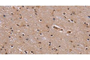 Immunohistochemistry of paraffin-embedded Human brain using GNL3 Polyclonal Antibody at dilution of 1:60 (Nucleostemin antibody)