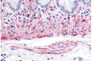 Human Colon, Smooth Muscle (formalin-fixed, paraffin-embedded) stained with TACR2 antibody ABIN213477 at 20 ug/ml followed by biotinylated goat anti-rabbit IgG secondary antibody ABIN481713, alkaline phosphatase-streptavidin and chromogen. (TACR2 antibody  (Extracellular Domain))