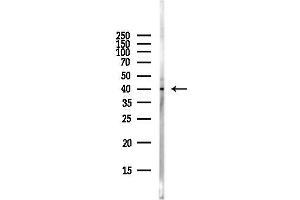 Western blot analysis of lysates from Hela cells(starvation,24h treatment), using RRM2B Antibody at 1/1000 dilution.