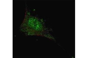 Fluorescent confocal image of SY5Y cells stained with SMAD2 antibody at 1:200. (SMAD2 antibody  (AA 201-230))