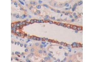 IHC-P analysis of Human Tissue, with DAB staining. (RALBP1 antibody  (AA 192-380))