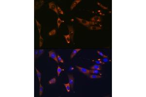 Immunofluorescence analysis of NIH-3T3 cells using ACLY Rabbit mAb (ABIN1678575, ABIN7101559, ABIN7101560 and ABIN7101561) at dilution of 1:100 (40x lens). (ACLY antibody)