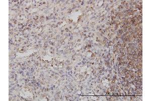 Immunostaining (ISt) image for anti-Cytohesin 1 (CYTH1) (AA 1-398) antibody (ABIN564003)